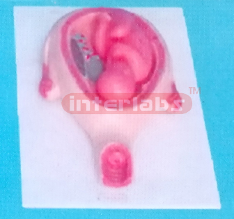 UTERUS WITH EMBRYO (8 MONTHS)